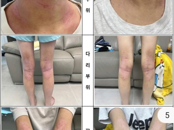 일상 속 외부 자극으로 지친 피부, 5일간의 집중 웰니스 컨디션 케어 기록